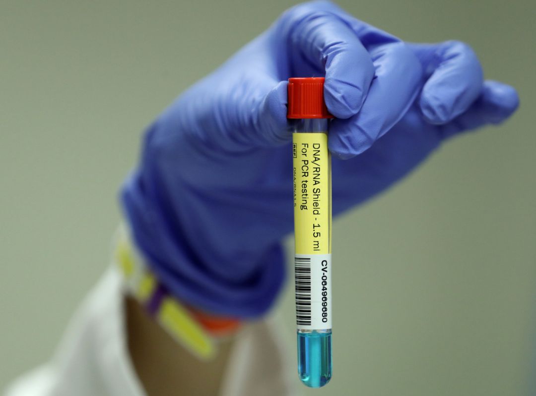 PCR test PCR test