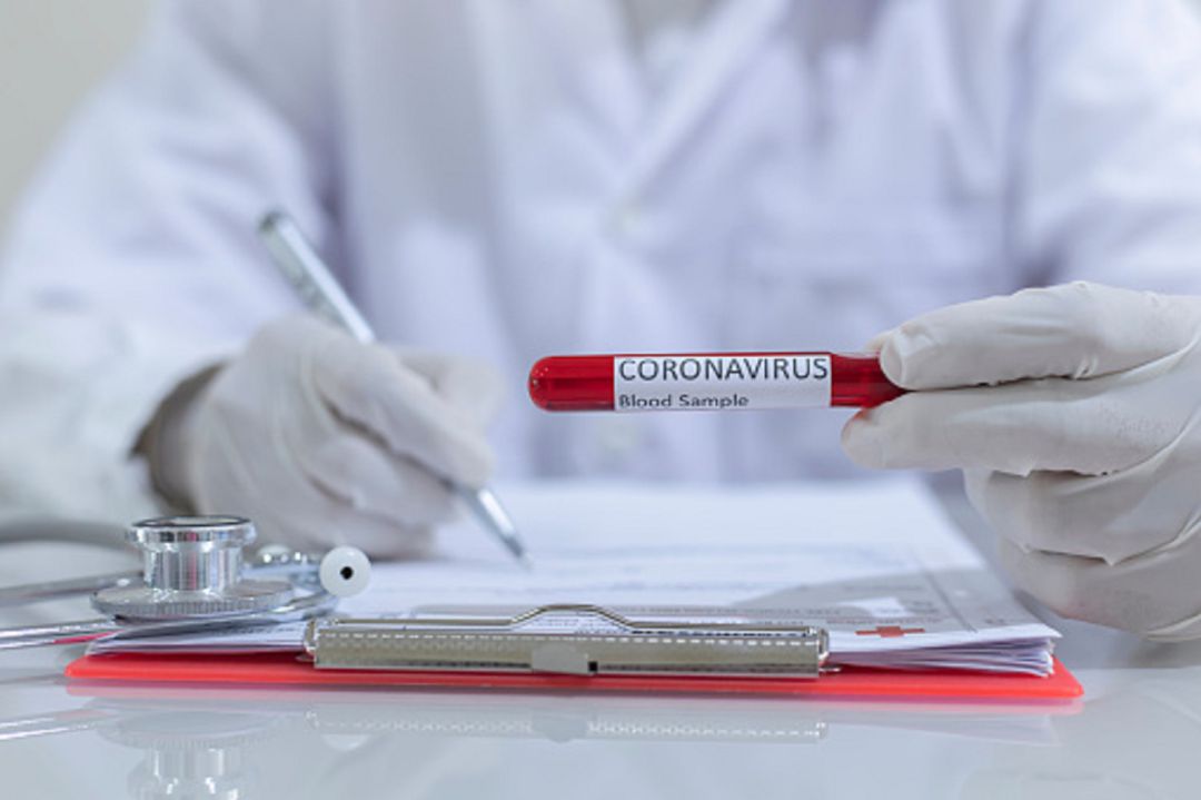 Análisis de coronavirus Análisis de coronavirus