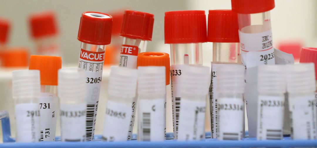 Muestras de sangre en un laboratorio. Muestras de sangre en un laboratorio.