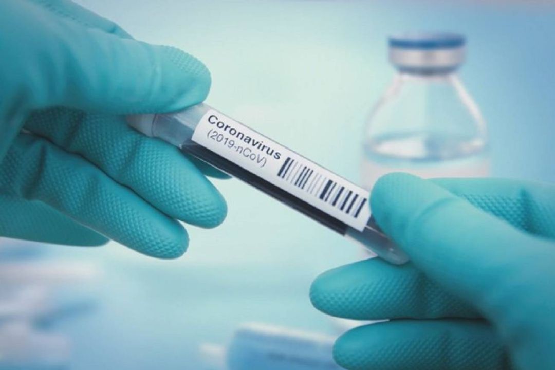 Tubo con muestra para prueba PCR. Tubo con muestra para prueba PCR.