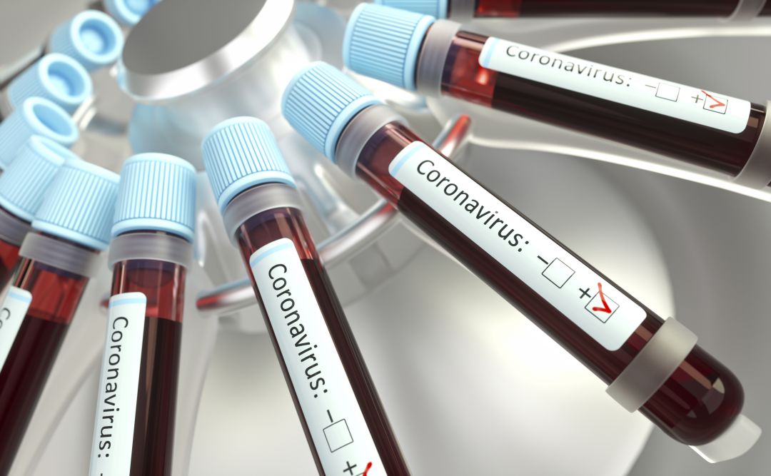Muestras de sangre Muestras de sangre