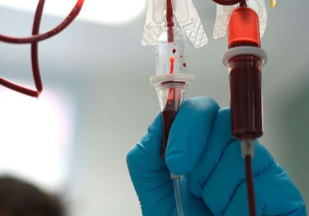 Osakidetza busca comprobar si mejoran los enfermos de COVID tratados con plasma de personas que han superado la enfermedad. Osakidetza busca comprobar si mejoran los enfermos de COVID tratados con plasma de personas que han superado la enfermedad.