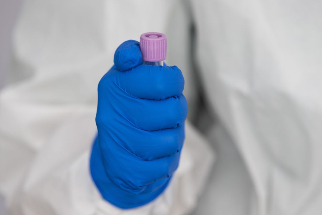 Una enfermera sostiene una PCR Una enfermera sostiene una PCR