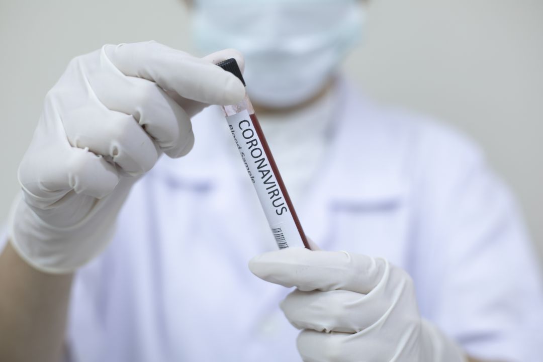 Imatge d'una prova PCR apunt de ser analitzada Imatge d'una prova PCR apunt de ser analitzada