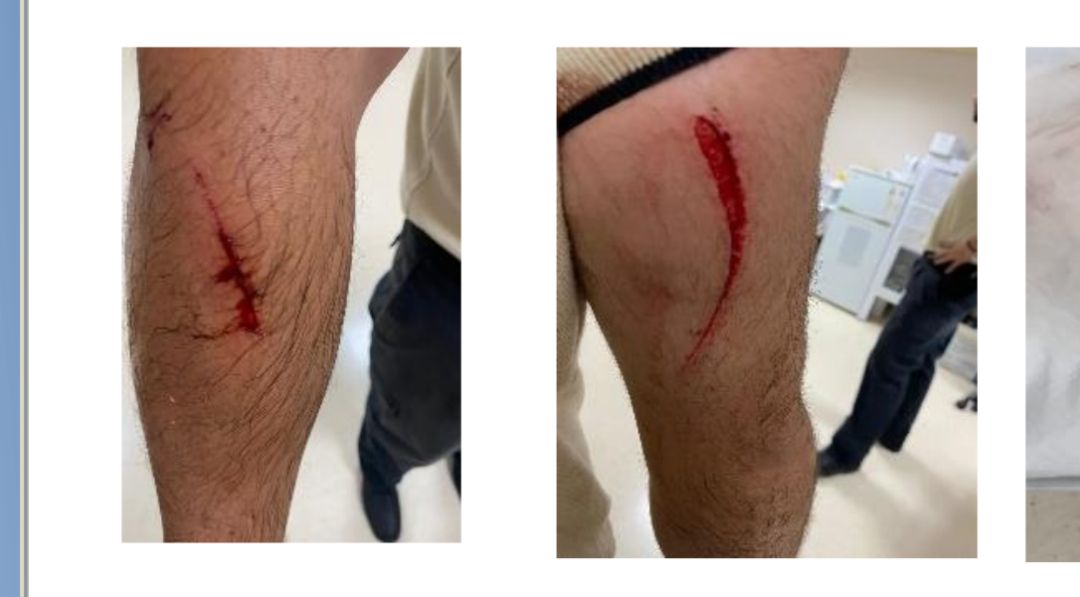 Imágenes de las heridas causadas por la agresión. Imágenes de las heridas causadas por la agresión.
