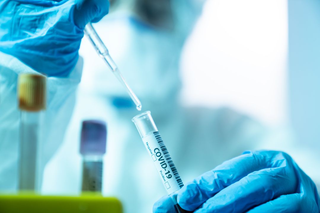 Un laboratori analitza els resutlats d'una PCR Un laboratori analitza els resutlats d'una PCR