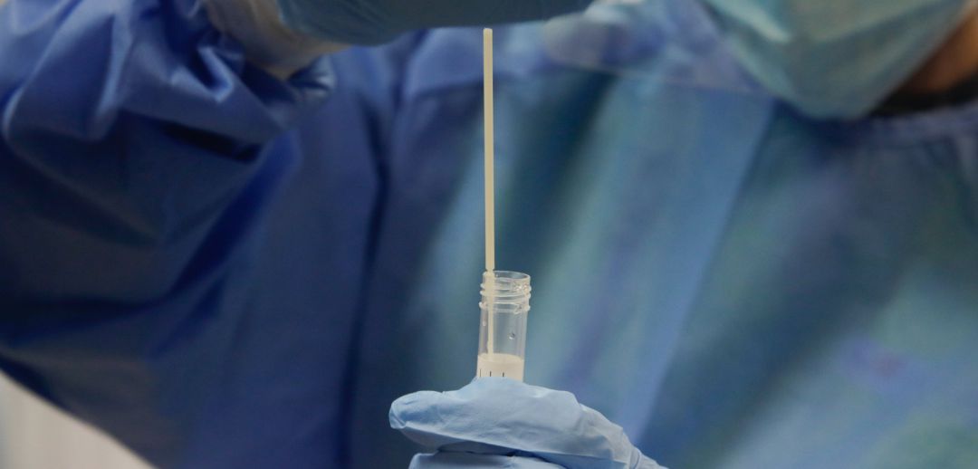 Una trabajadora sanitaria sostiene una probeta con una prueba PCR Una trabajadora sanitaria sostiene una probeta con una prueba PCR