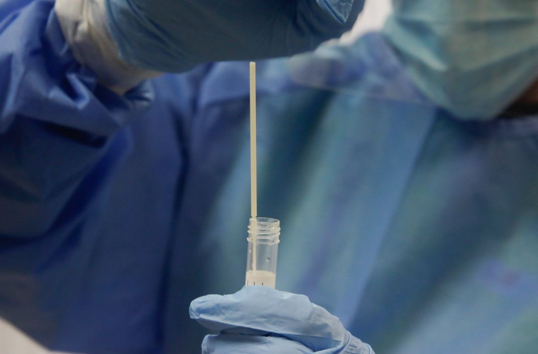 Una trabajadora sanitaria sostiene una probeta con una prueba PCR Una trabajadora sanitaria sostiene una probeta con una prueba PCR