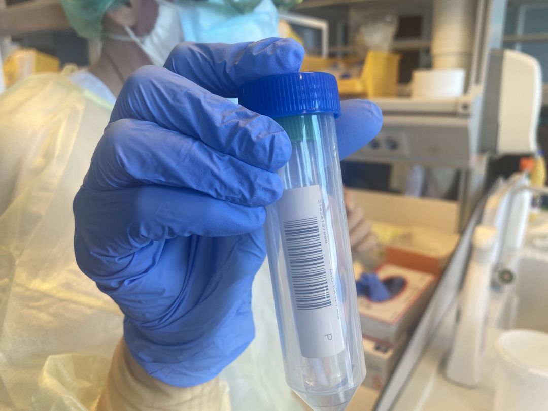 Prueba PCR Prueba PCR