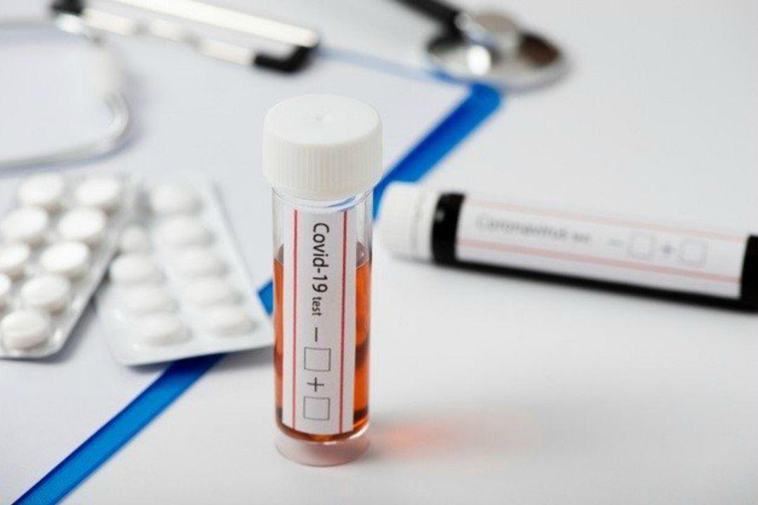 Los test de antígenos son una herramienta para controlar la pandemia. Los test de antígenos son una herramienta para controlar la pandemia.