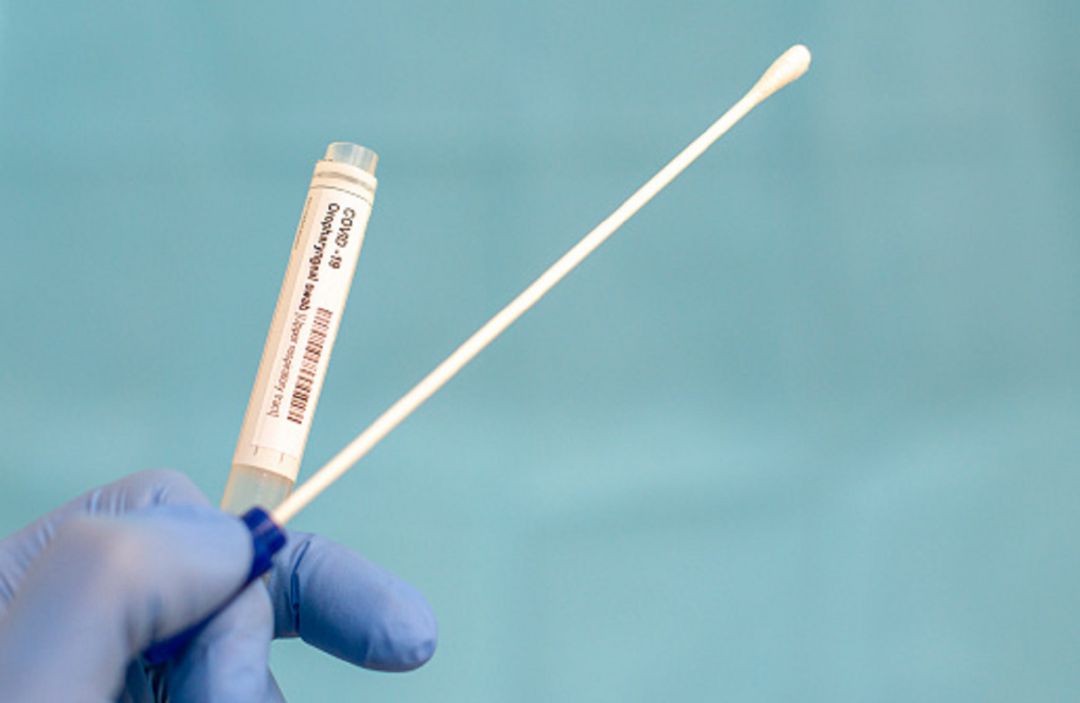 Test de coronavirus Test de coronavirus