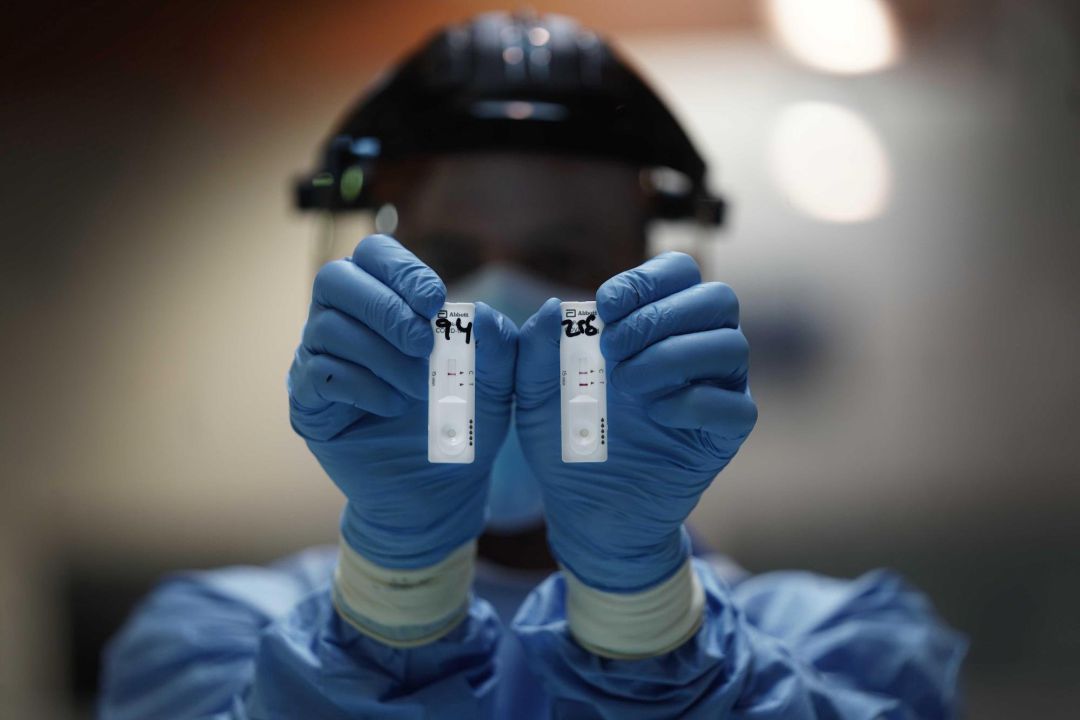 - Un sanitario sostiene dos pruebas de test rápido de antígenos en la mano para la detección de la COVID-19 durante el cribado extraordinario voluntario que la Junta de Andalucía ha comenzado esta mañana a realizar a 342 personas en la localidad cordodesa de Almodóvar del Río, debido a la situación de incidencia de coronavirus en la zona. EFERafa Alcaide - Un sanitario sostiene dos pruebas de test rápido de antígenos en la mano para la detección de la COVID-19 durante el cribado extraordinario voluntario que la Junta de Andalucía ha comenzado esta mañana a realizar a 342 personas en la localidad cordodesa de Almodóvar del Río, debido a la situación de incidencia de coronavirus en la zona. EFERafa Alcaide