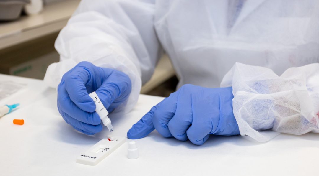 Una manos de sanitario con guantes de nitrilo realizan un test Una manos de sanitario con guantes de nitrilo realizan un test
