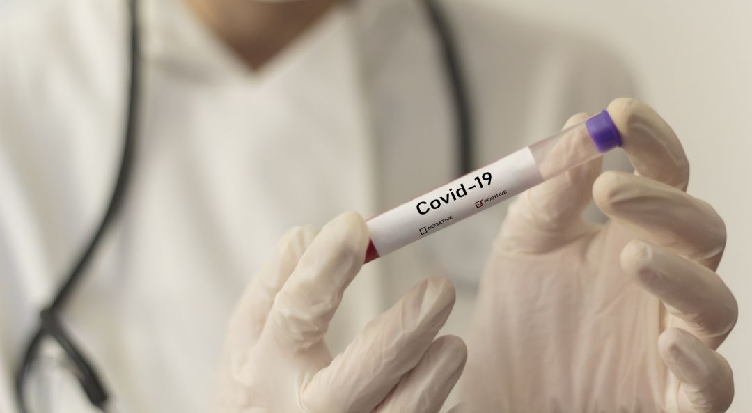 Dos personas han fallecido por coronavirus en las últimas 24 horas Dos personas han fallecido por coronavirus en las últimas 24 horas