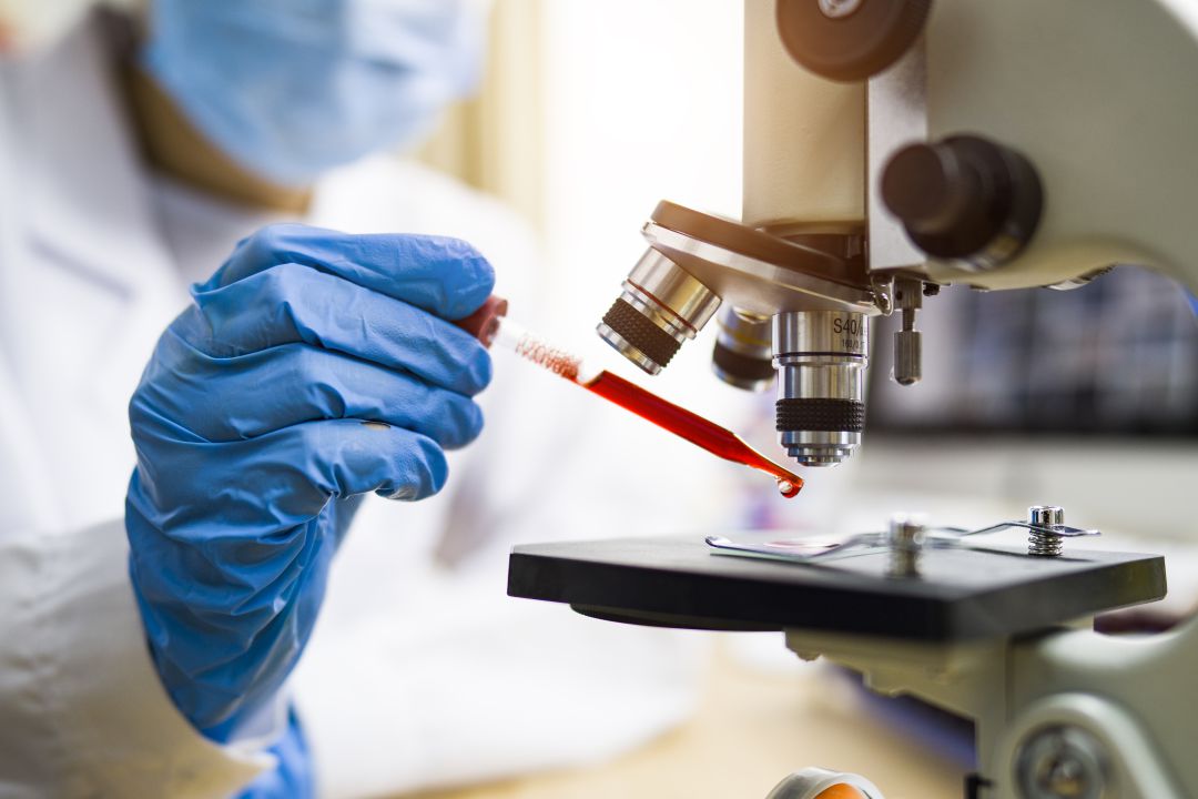 Prueba PCR Prueba PCR