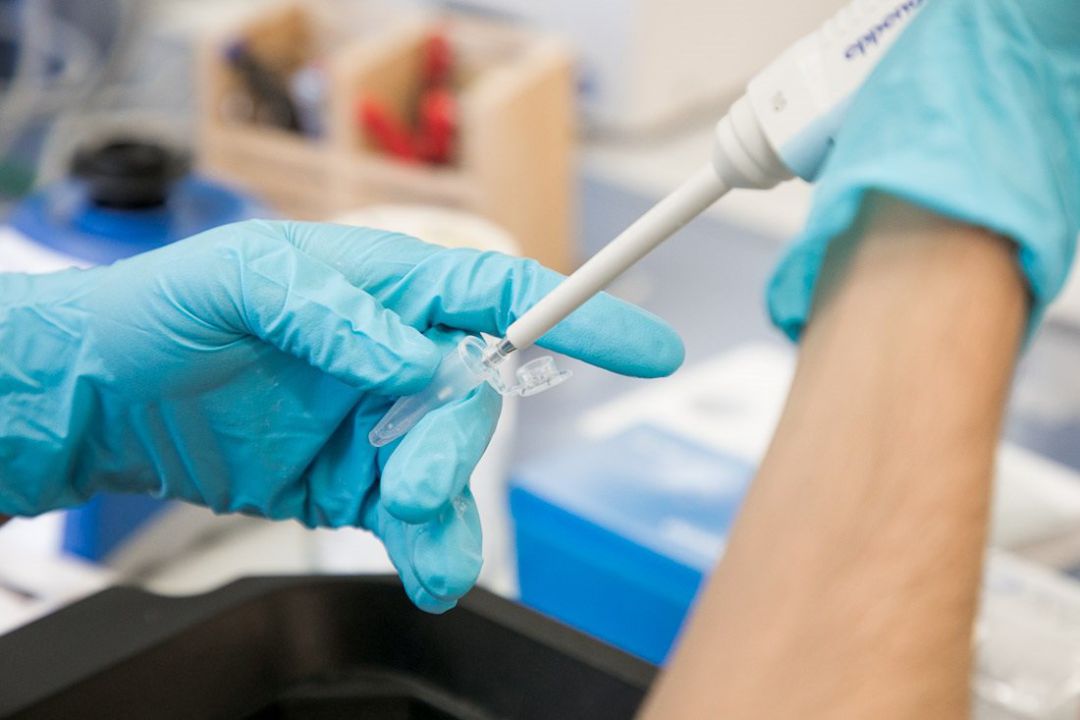 Análisis de una prueba PCR Análisis de una prueba PCR