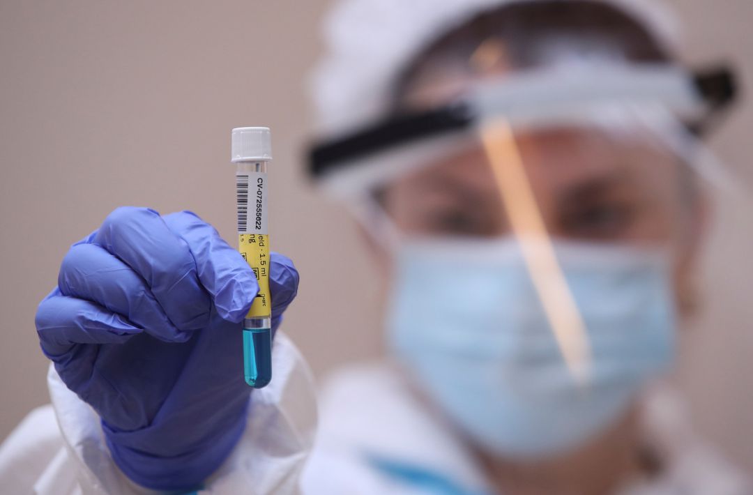 Un sanitario muestra un test PCR Un sanitario muestra un test PCR