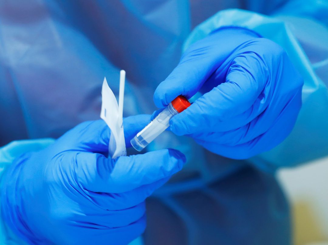 Prueba PCR Prueba PCR