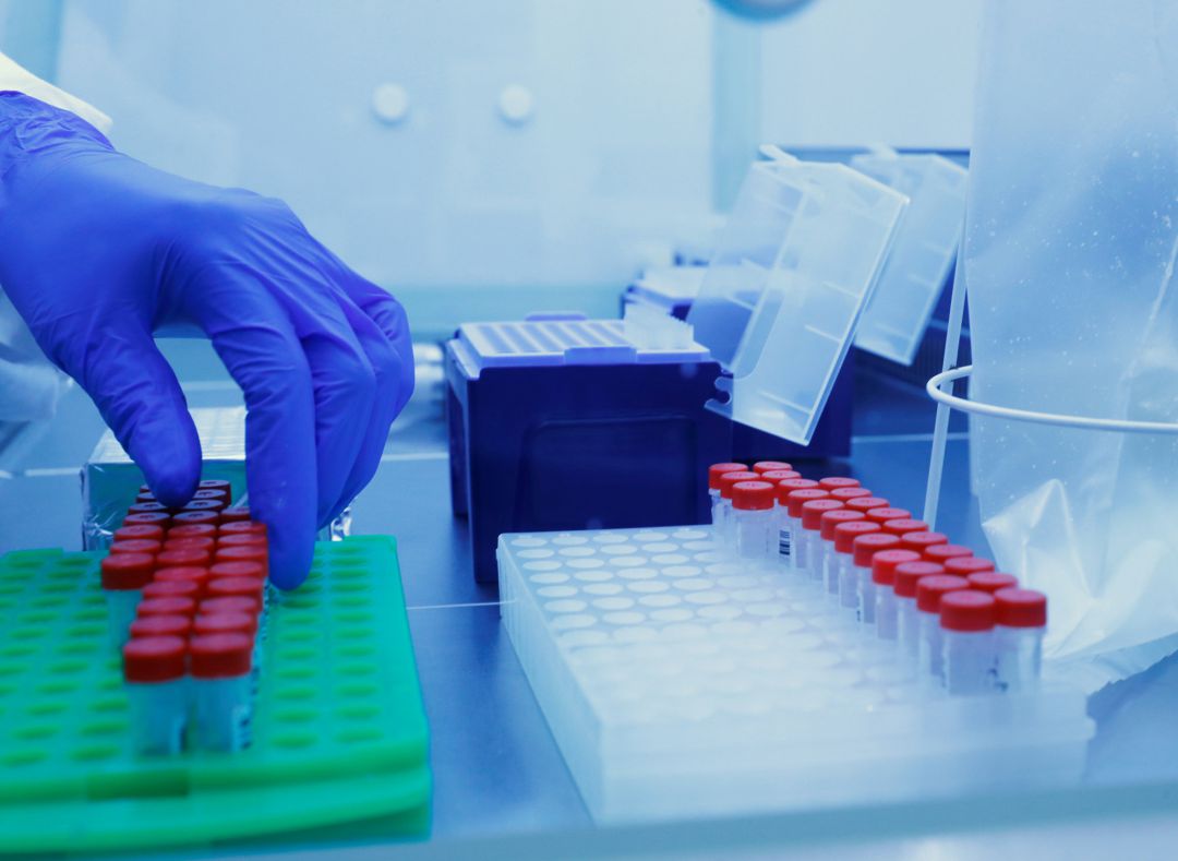 Muestras PCR en una laboratorio. Muestras PCR en una laboratorio.
