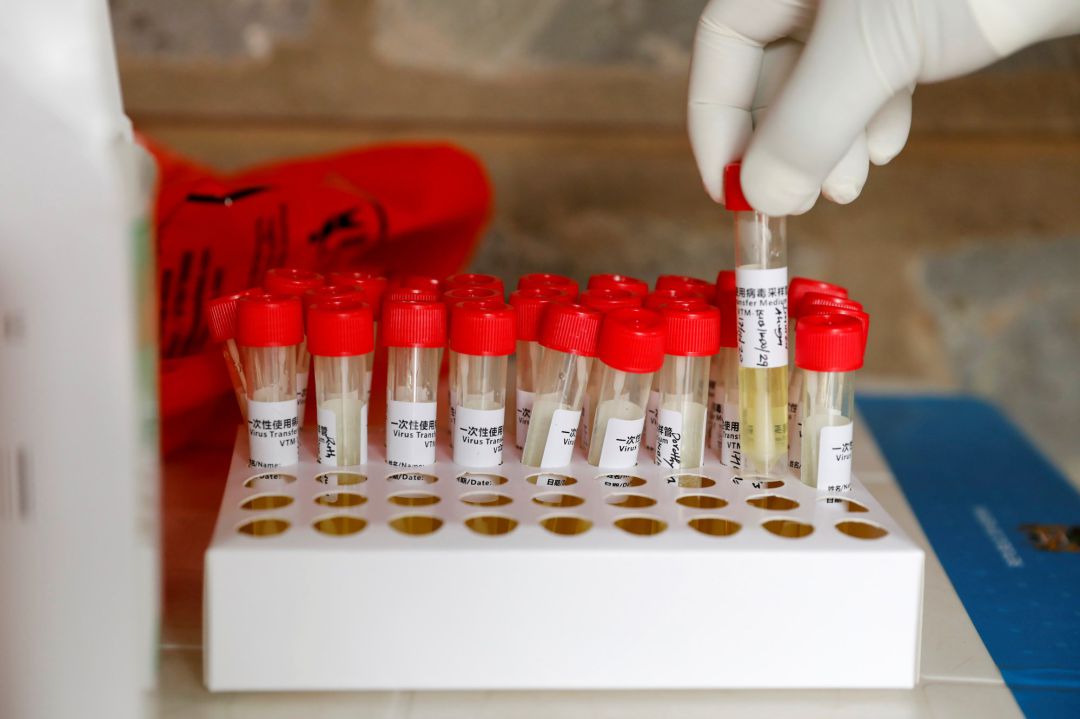 Pruebas PCR Pruebas PCR