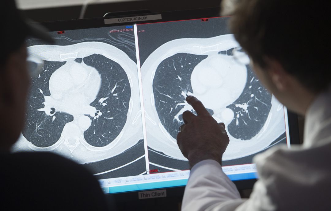 Los programas de detección de cáncer, afectados por el coronavirus Los programas de detección de cáncer, afectados por el coronavirus