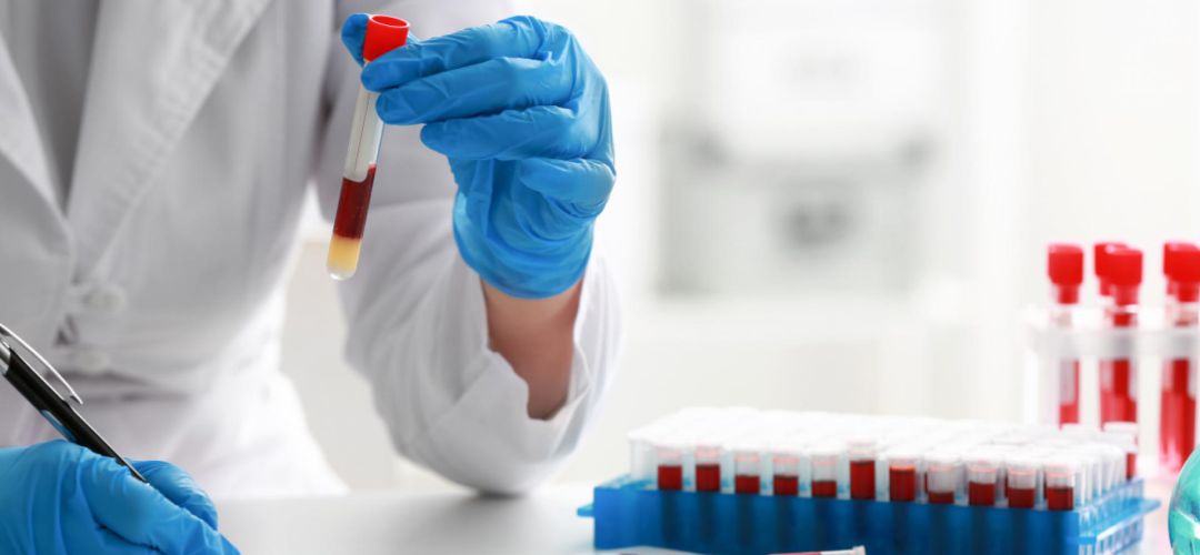 Pruebas médicas de laboratorio Pruebas médicas de laboratorio