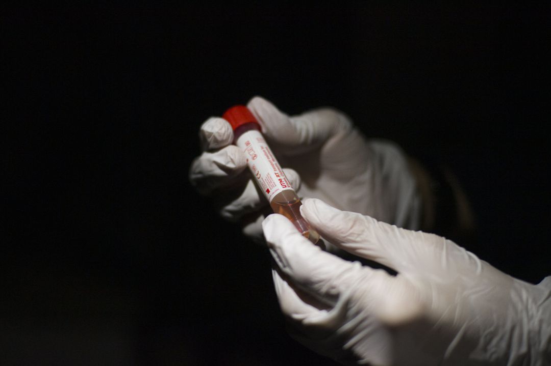 Un médico sujeta una muestra para la detección de coronavirus. Un médico sujeta una muestra para la detección de coronavirus.