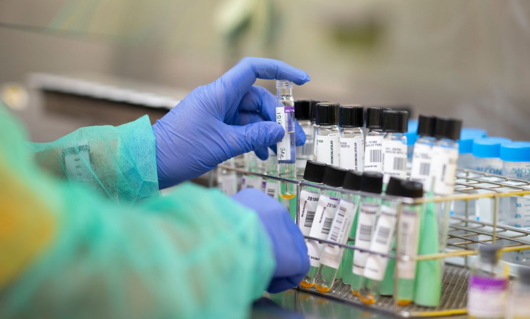 Muestras de PCR para analizar Muestras de PCR para analizar