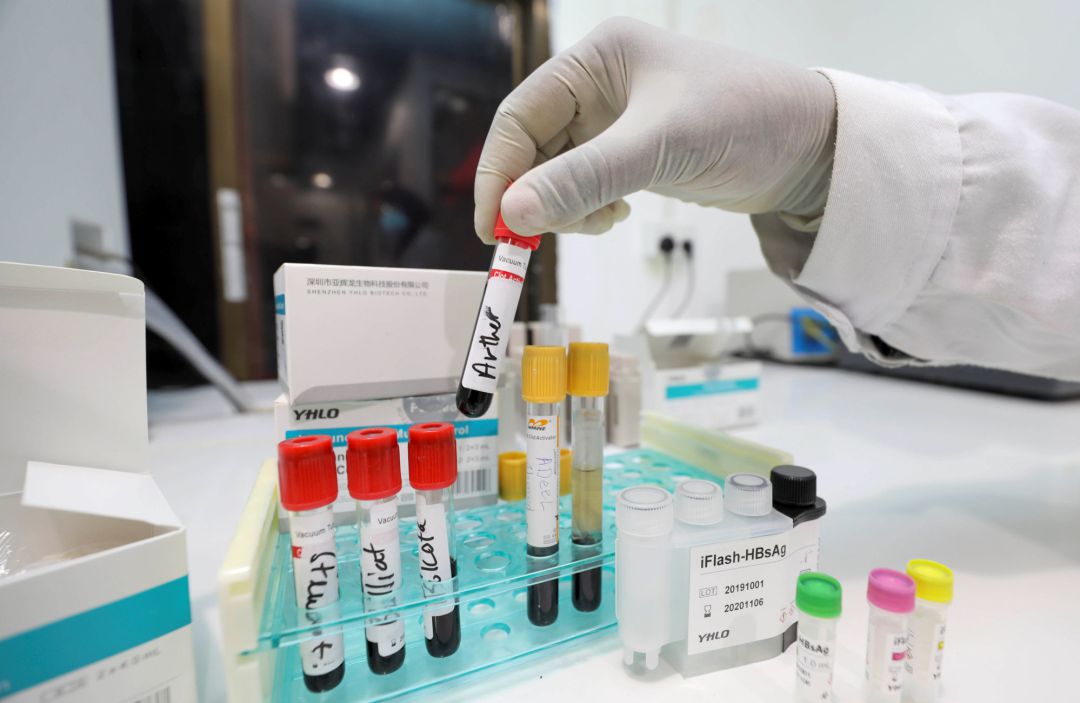 Un laboratorio, con muestras de sangre. Un laboratorio, con muestras de sangre.