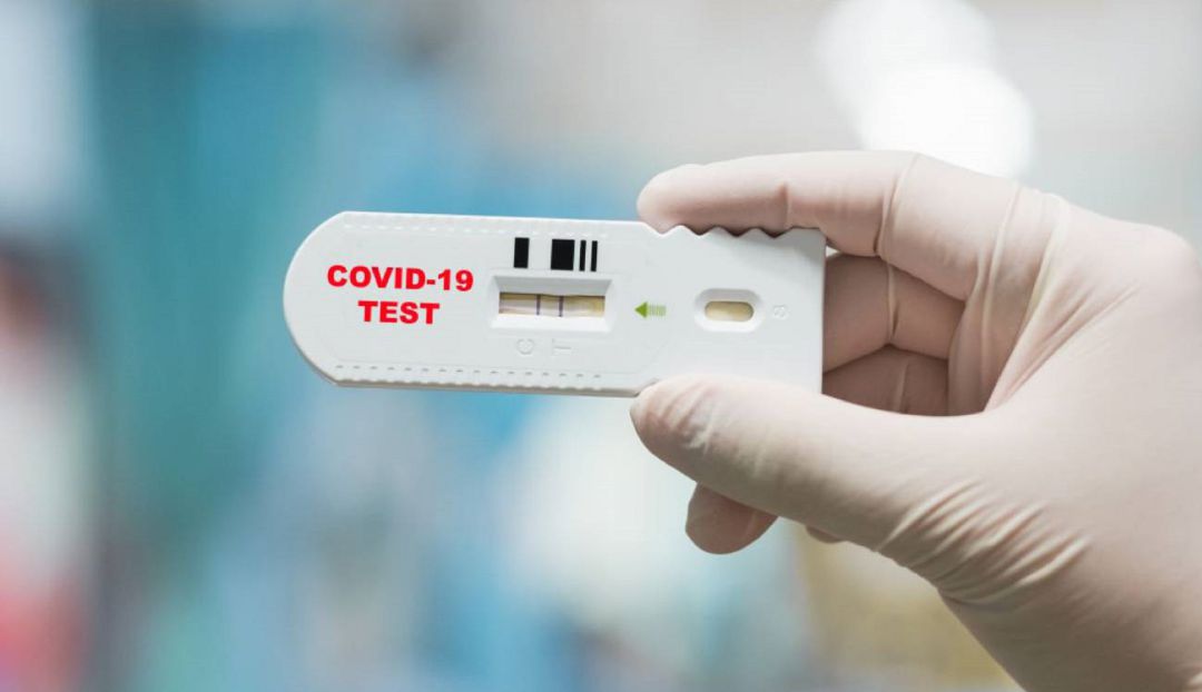Serranillos del Valle será municipio pionero en la realización de los test de saliva para detectar la COVID-19 Serranillos del Valle será municipio pionero en la realización de los test de saliva para detectar la COVID-19