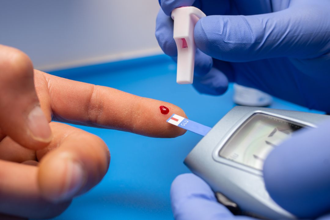 Los pacientes con diabetes deben medirse el nivel de glucosa en sangre para evitar subidas de azúcar. Los pacientes con diabetes deben medirse el nivel de glucosa en sangre para evitar subidas de azúcar.