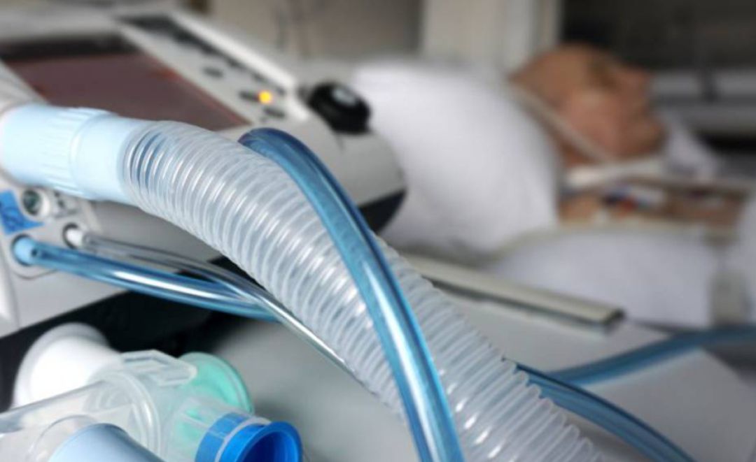 Respirador con ventilación mecánica Respirador con ventilación mecánica