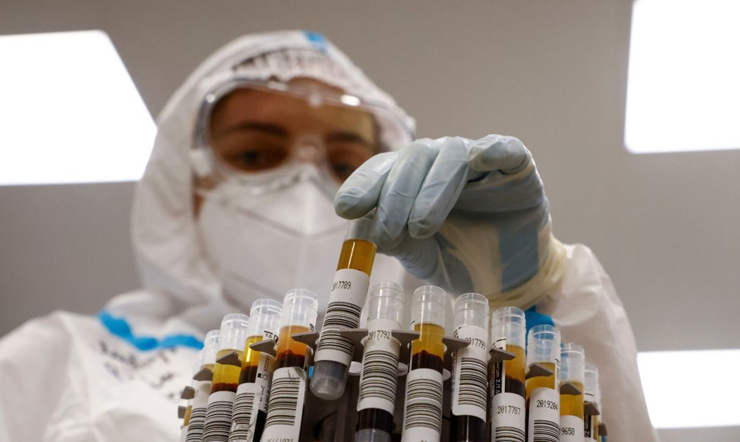 Un sanitario examina test de coronavirus en pacientes. Un sanitario examina test de coronavirus en pacientes.