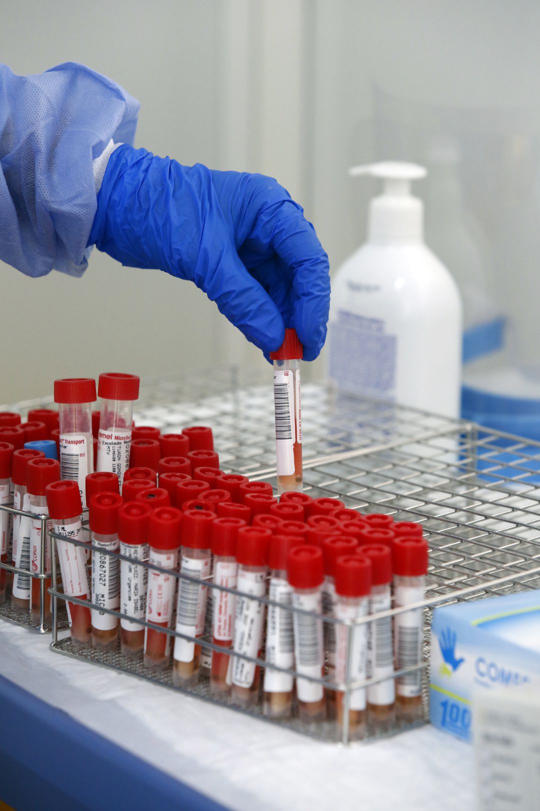Tubos de pruebas PCR para la detección del COVID-19. Tubos de pruebas PCR para la detección del COVID-19.
