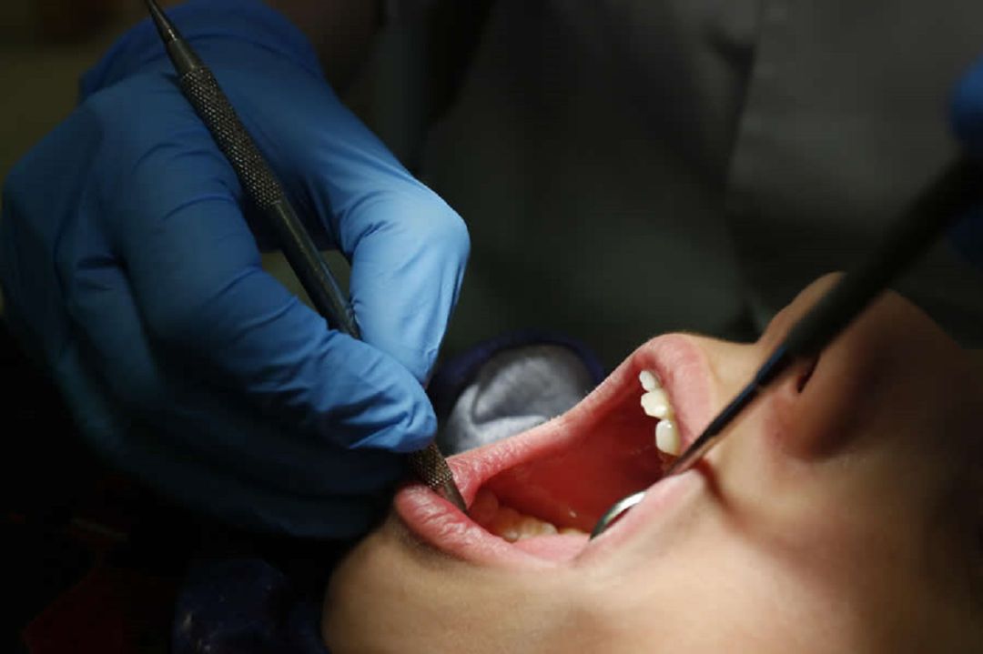 Un dentista realiza una revisión bucodental. Un dentista realiza una revisión bucodental.