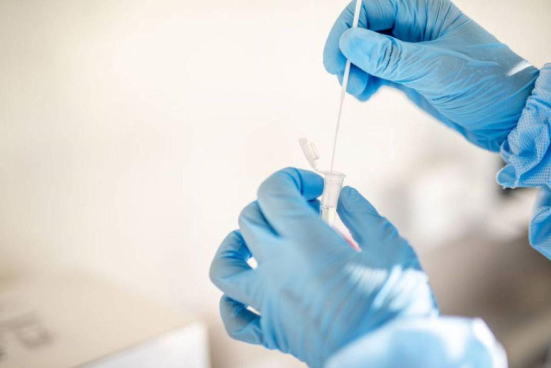 Pruebas PCR Pruebas PCR