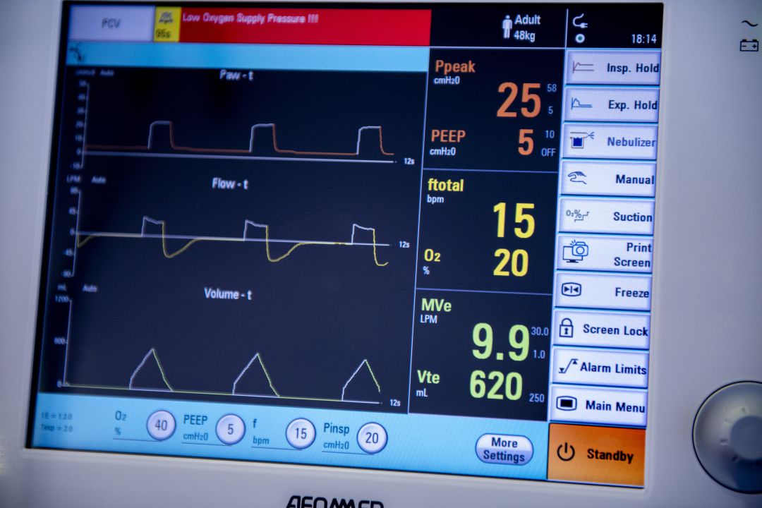 Pantalla de un respirador en el Hospital San Pedro de Logroño. Pantalla de un respirador en el Hospital San Pedro de Logroño.