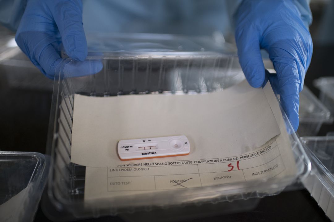 Una muestra de un test del coronavirus. Una muestra de un test del coronavirus.