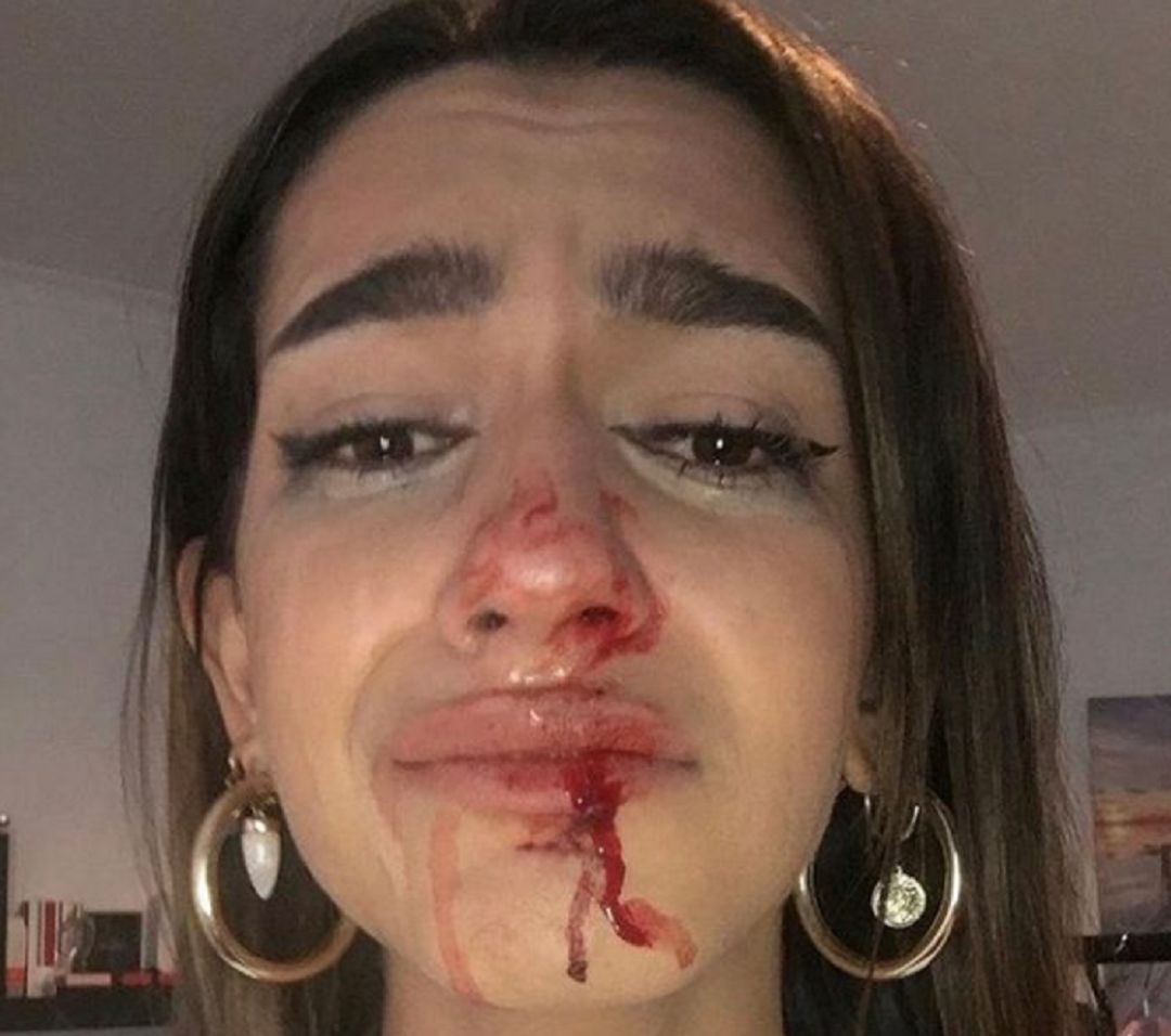 La joven transexual denuncia en redes sociales la agresión sufrida por su condición trans. La joven transexual denuncia en redes sociales la agresión sufrida por su condición trans.