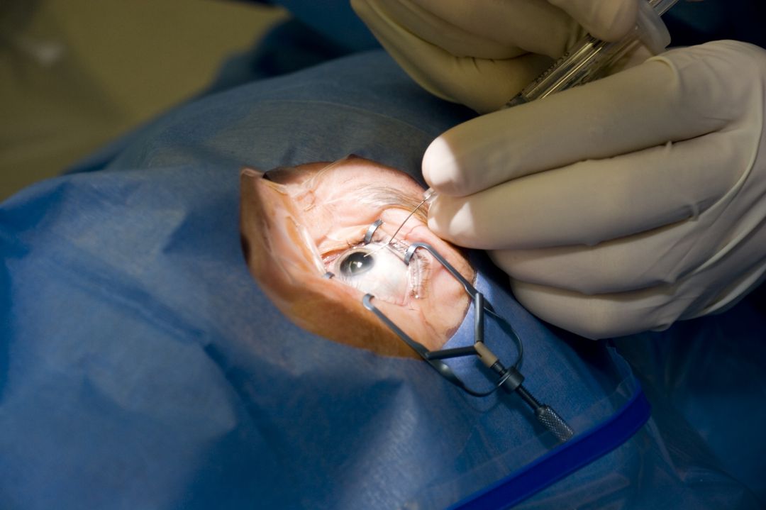 La operación de cataratas se produjo en el año 2014 en el Hospital General de València. La operación de cataratas se produjo en el año 2014 en el Hospital General de València.
