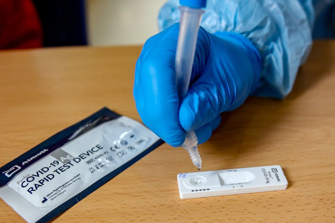 Material necesario para la realización de test de antígenos Material necesario para la realización de test de antígenos