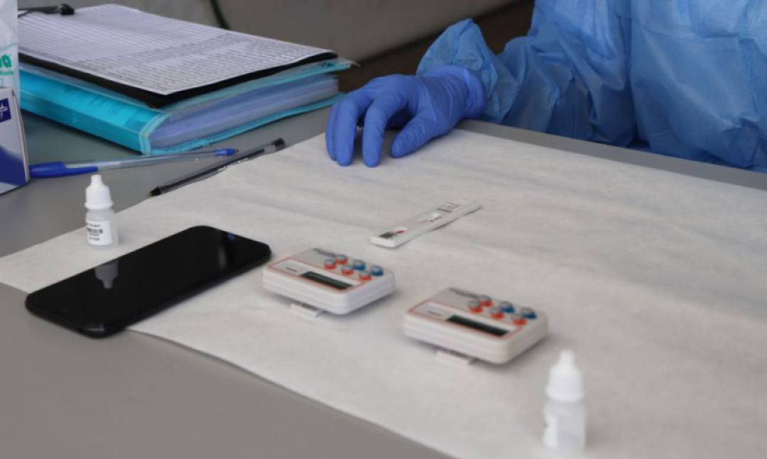 Imagen de archivo de una prueba PCR Imagen de archivo de una prueba PCR