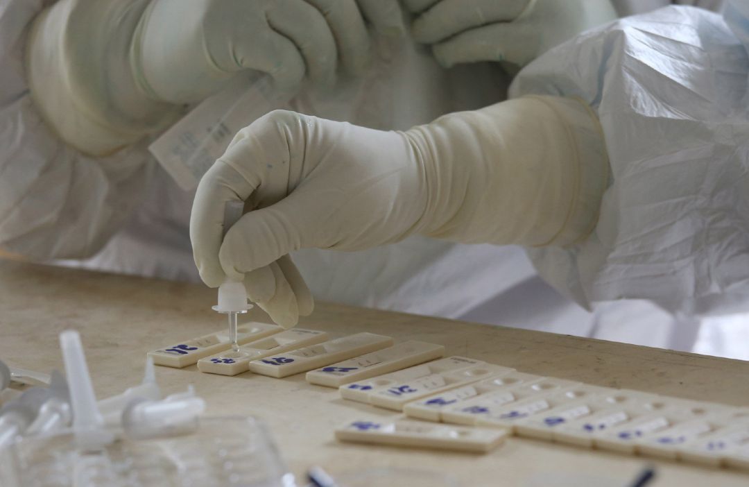Posibles muestras del virus, a análisis Posibles muestras del virus, a análisis