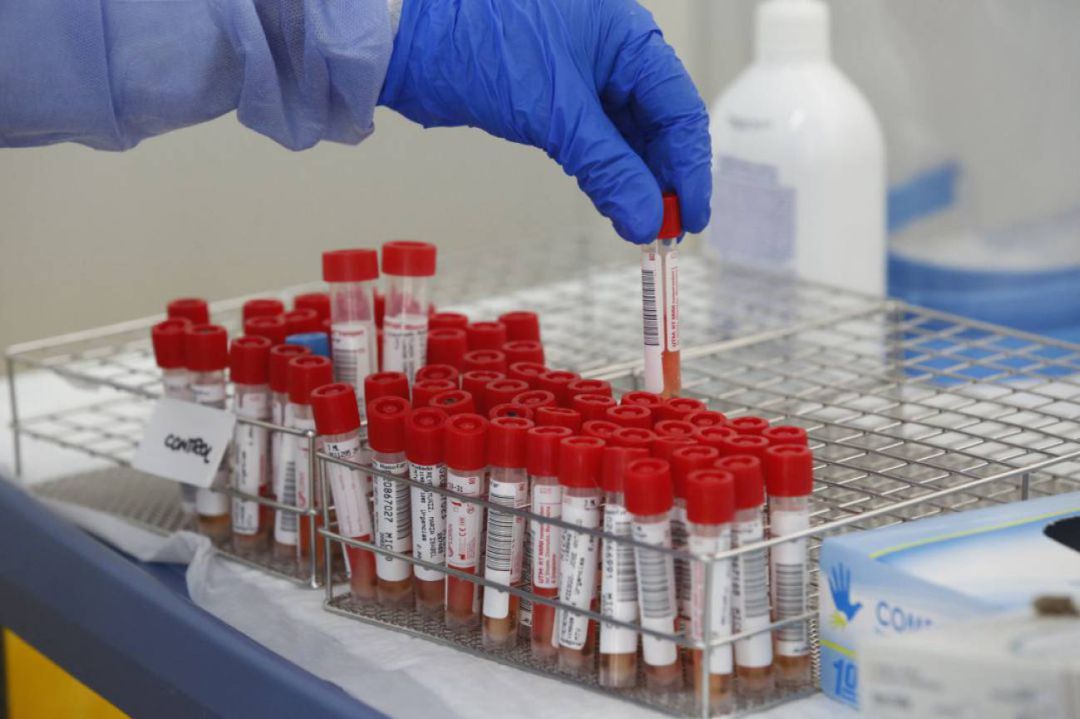 Desde el inicio de la pandemia, en la provincia, han fallecido 316 personas, 11.232 se han contagiado y 10.569 han superado la enfermedad. Desde el inicio de la pandemia, en la provincia, han fallecido 316 personas, 11.232 se han contagiado y 10.569 han superado la enfermedad.