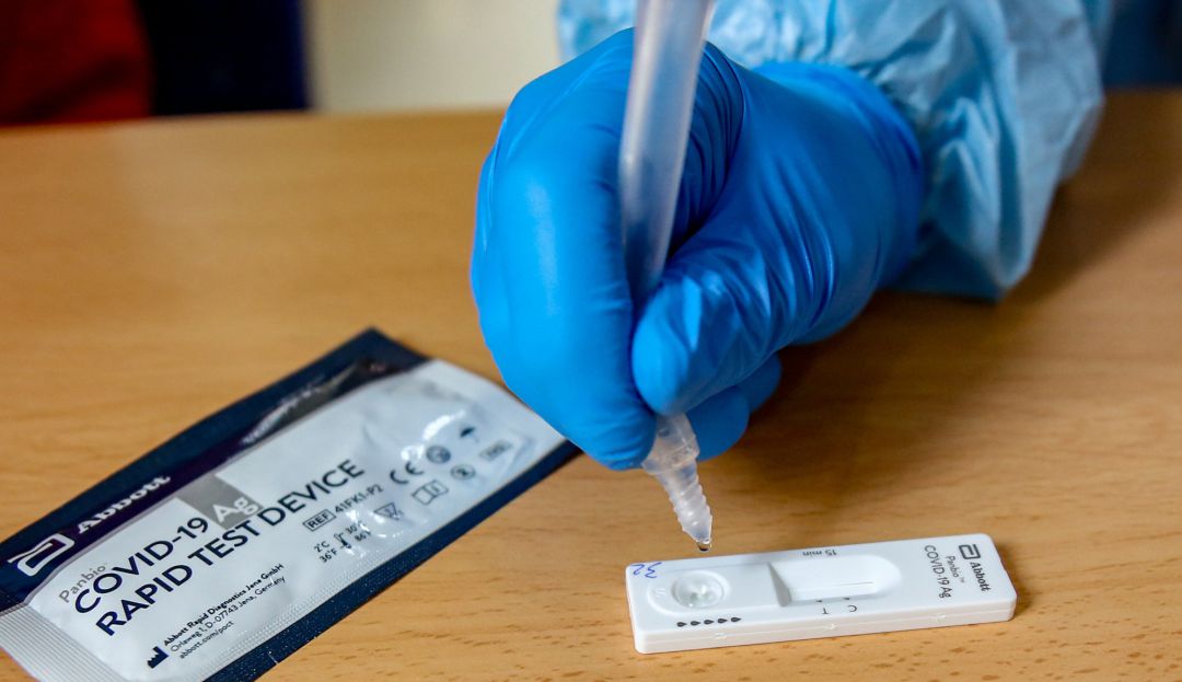 Material necesario para la realización de test de antígenos Material necesario para la realización de test de antígenos