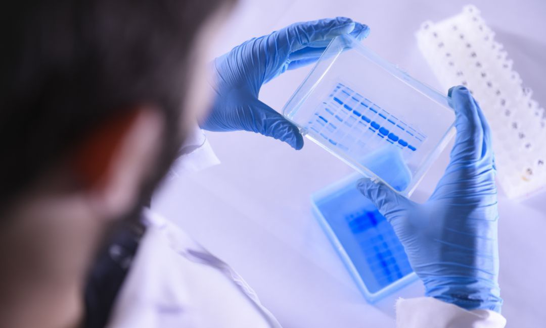 Pruebas de COVID 19 analizadas en un laboratorio Pruebas de COVID 19 analizadas en un laboratorio