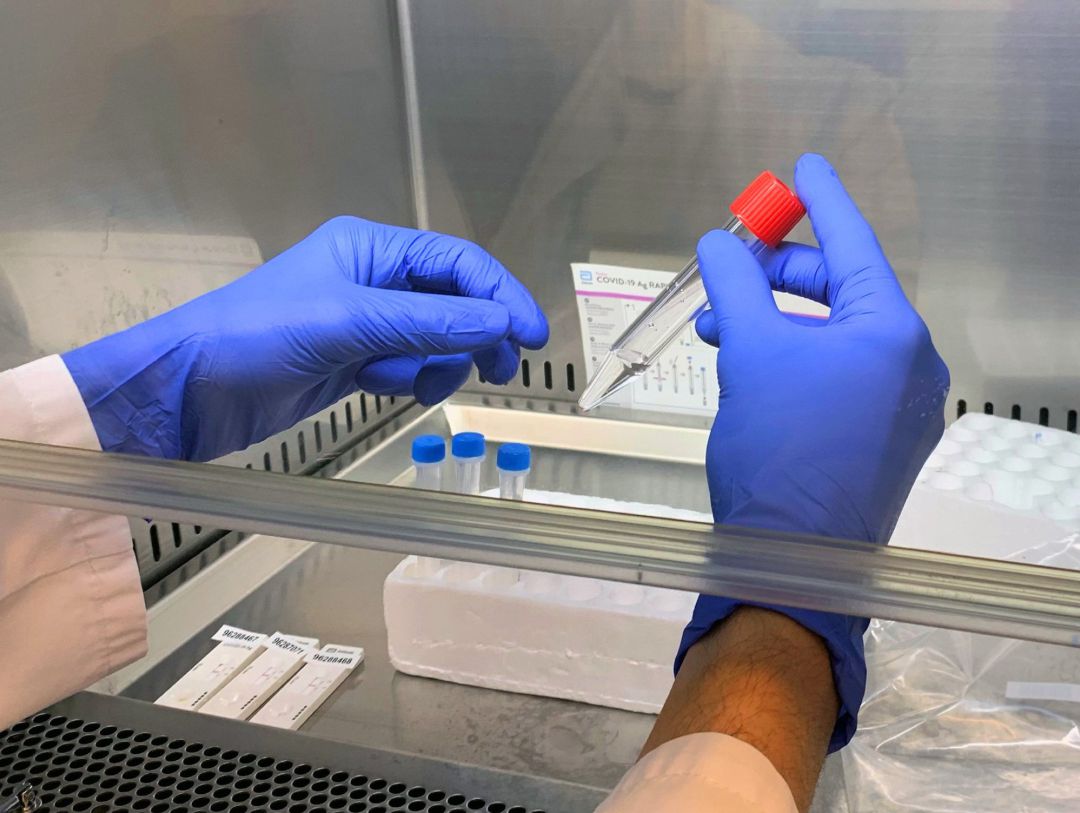 Una PCR con muestra en saliva para detectar la COVID-19, en un hospital de Quirónsalud Una PCR con muestra en saliva para detectar la COVID-19, en un hospital de Quirónsalud