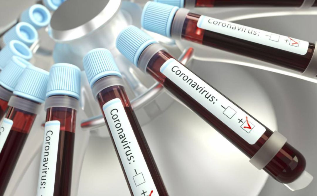 Muestras para la realización de pruebas de Covid-19 Muestras para la realización de pruebas de Covid-19