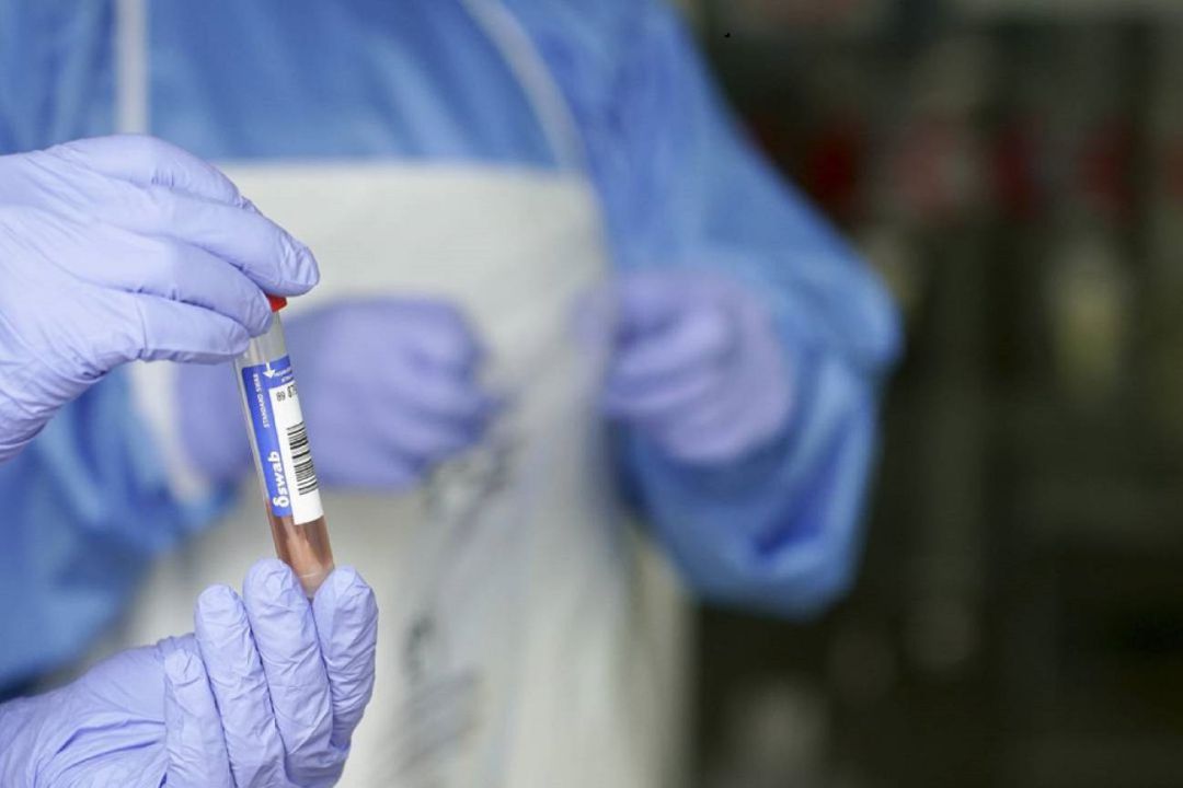 Datos sobre la incidencia de la pandemia de coronavirus en Palencia Datos sobre la incidencia de la pandemia de coronavirus en Palencia