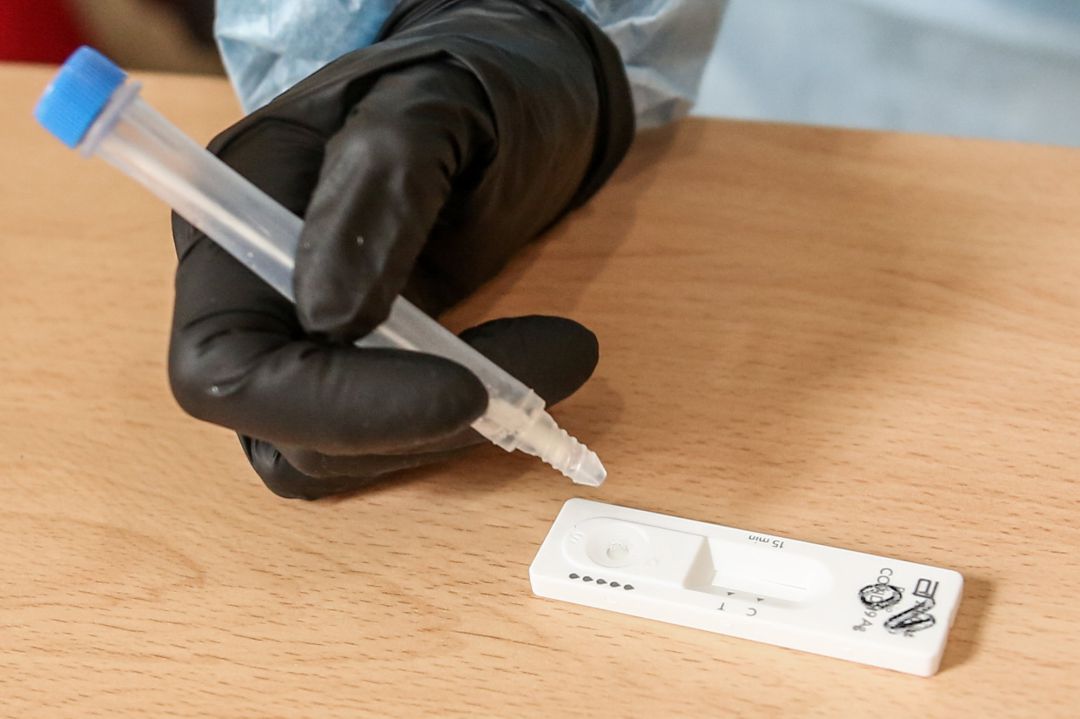 Material necesario para la realización de test de antígenos Material necesario para la realización de test de antígenos